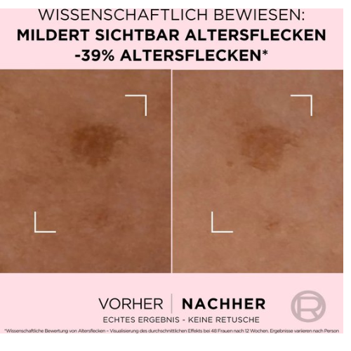 L'Oréal Paris Age Perfect sérum contre les taches de vieillesse 30 ml