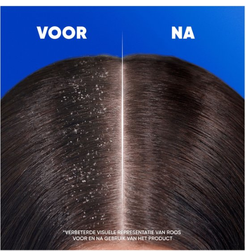 Head & Shoulders Menthol Fresh - Anti-Roos Shampoo - Dagelijks Gebruik - Fris Gevoel - 400ml